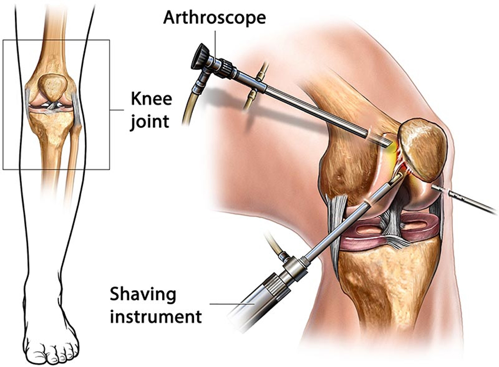 Arthroscopy_3157